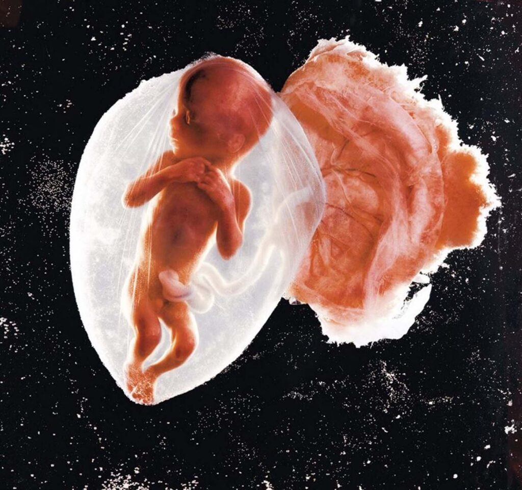 Έμβρυο 18 εβδομάδων, 1965